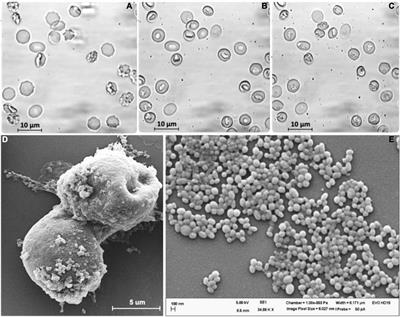 The Relation Between Extracellular Vesicles Released From Red Blood Cells, Their Cargo, and the Clearance by Macrophages